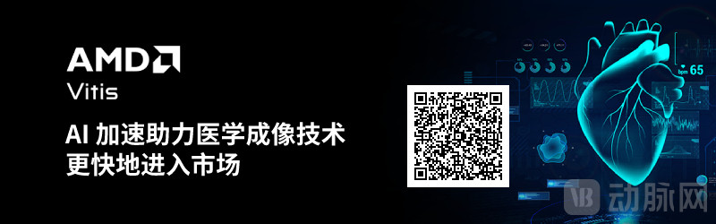 Ultrasound VB100 800x250.jpg