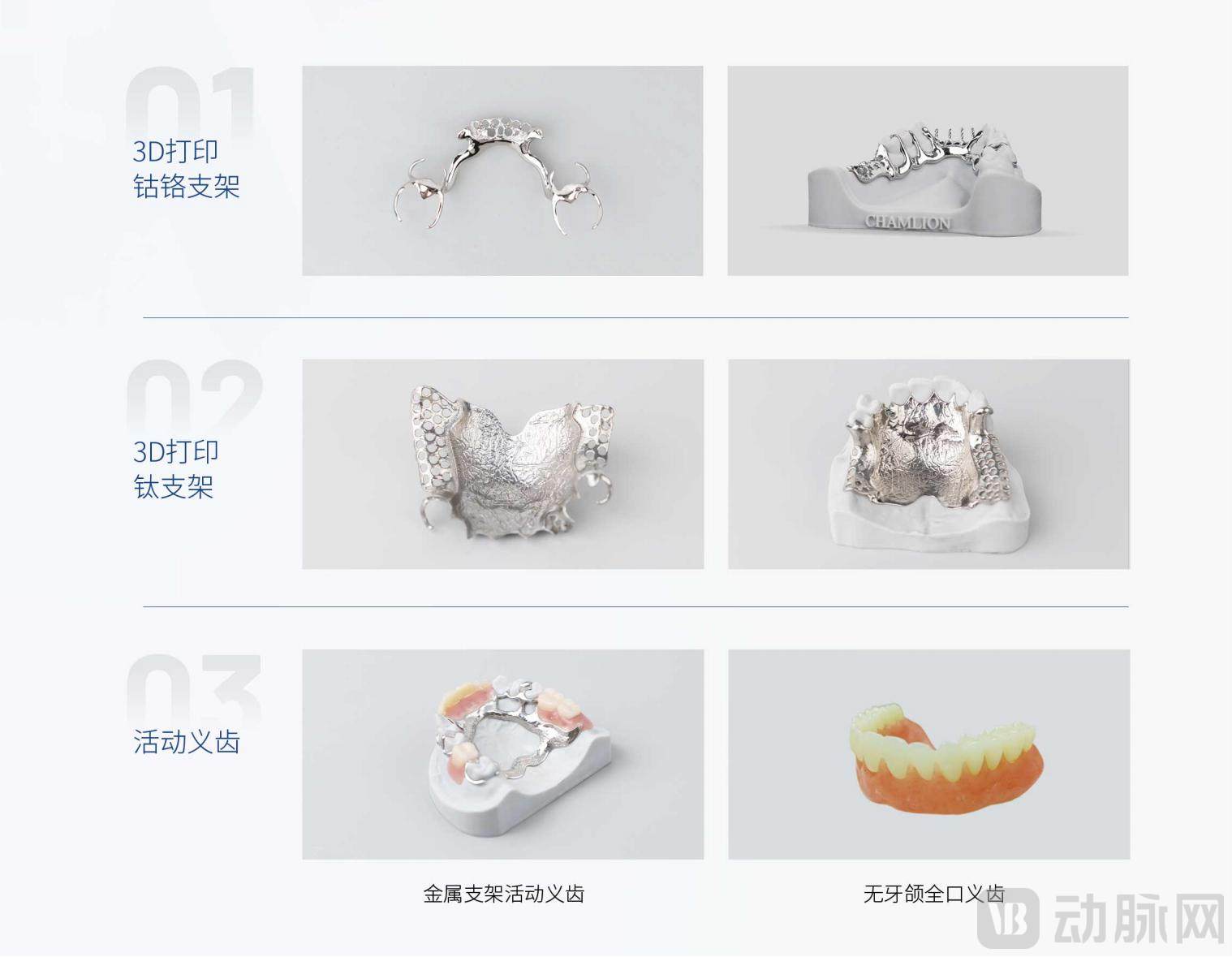 02 支架+牙冠.jpg