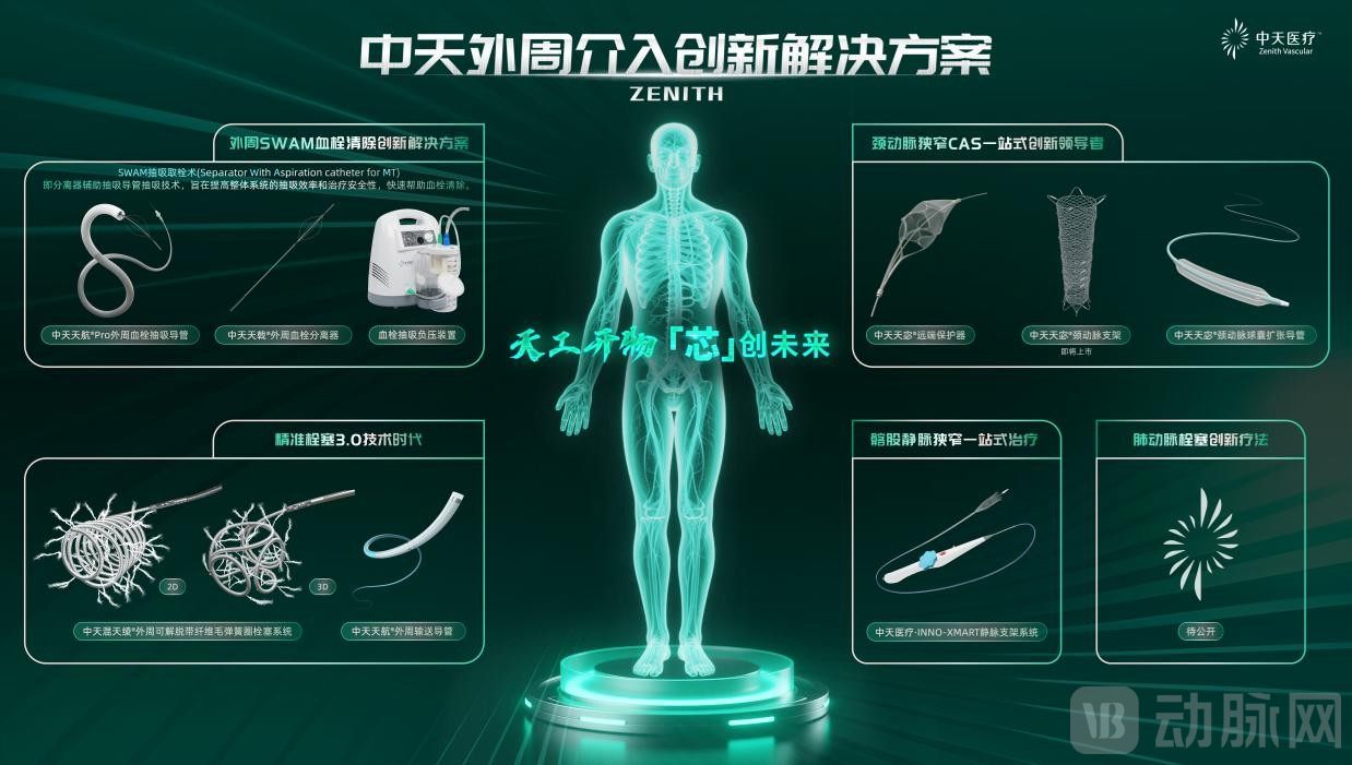 外周介入产品图.jpg