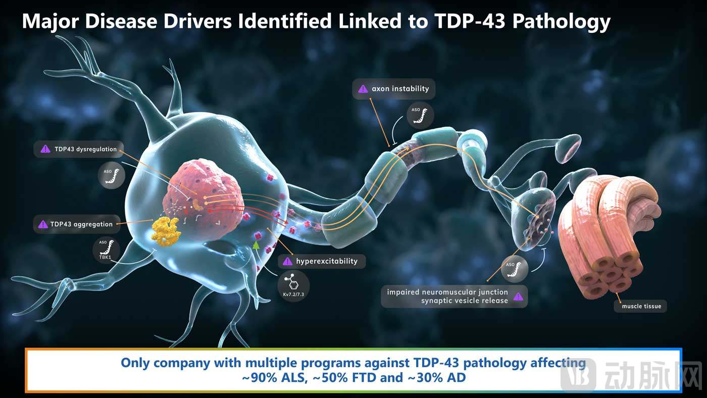 TDP43-pathology-image-lg.jpg