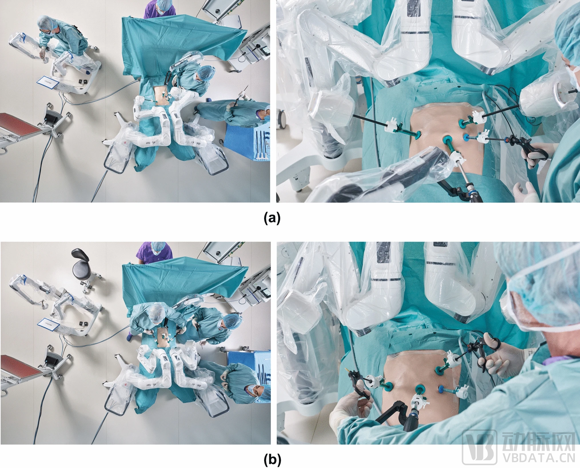 按需机器人操作过程中的模式切换。(a) 机器人模式下典型 Dexter 手术装置的俯视图和正视图。(b）腹腔镜模式下典型 Dexter 手术装置的俯视图和正视图。两个器械臂都折叠起来，以便为标准腹腔镜手术创造足够的空间。.png