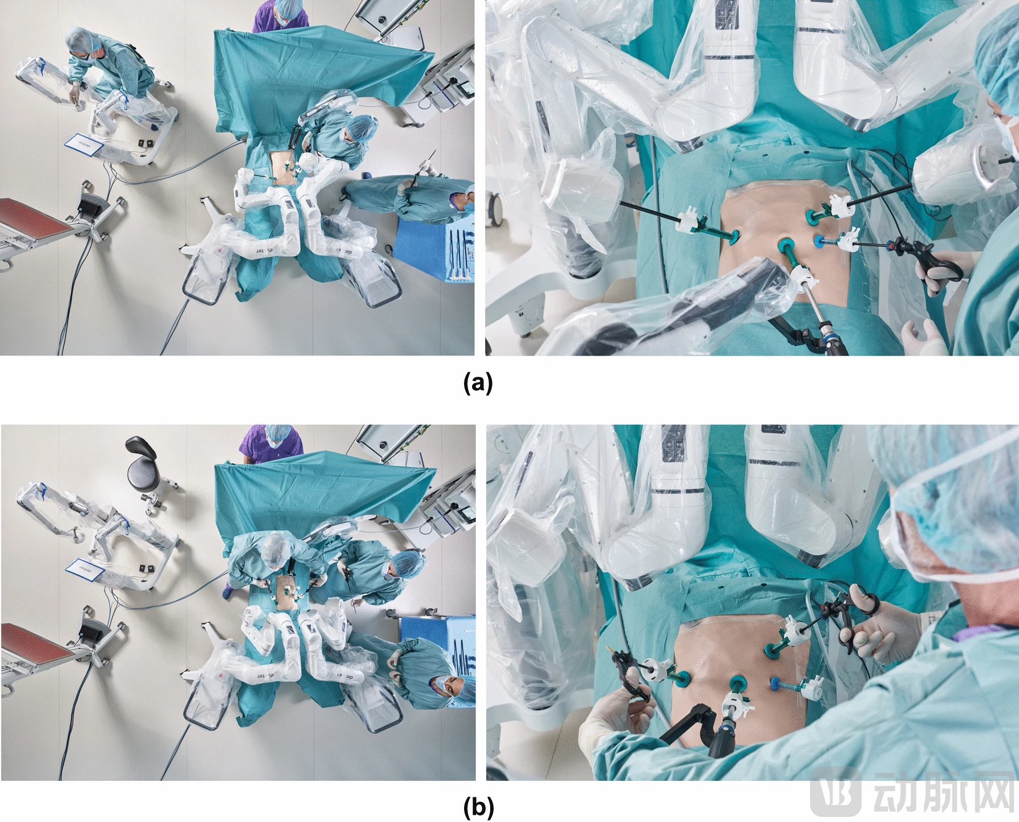 按需机器人操作过程中的模式切换。(a) 机器人模式下典型 Dexter 手术装置的俯视图和正视图。(b）腹腔镜模式下典型 Dexter 手术装置的俯视图和正视图。两个器械臂都折叠起来，以便为标准腹腔镜手术创造足够的空间。.png
