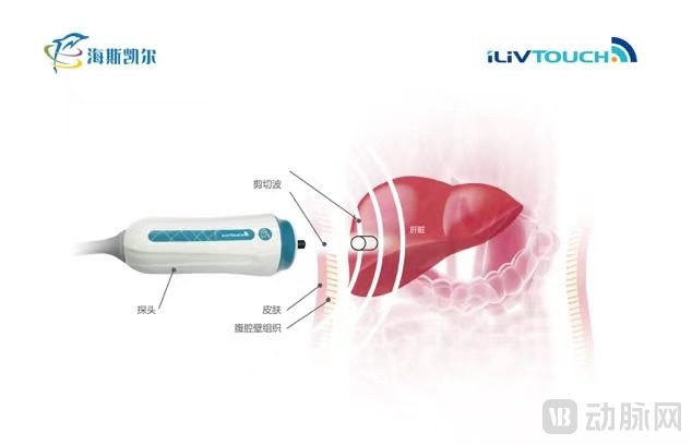 海斯凯尔产品.jpg