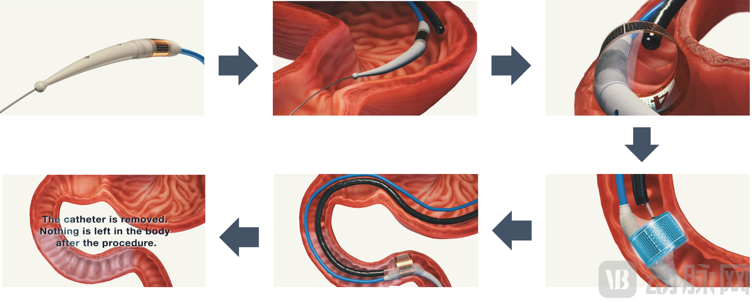 未命名的设计 (3).png