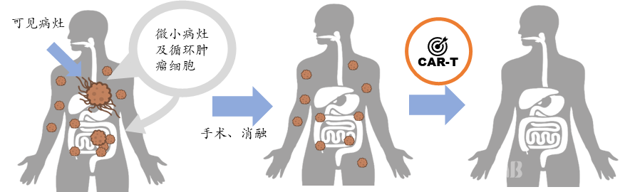 “化实体瘤为血液瘤”临床策略.png