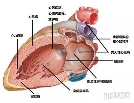 结构性心脏病.jpg