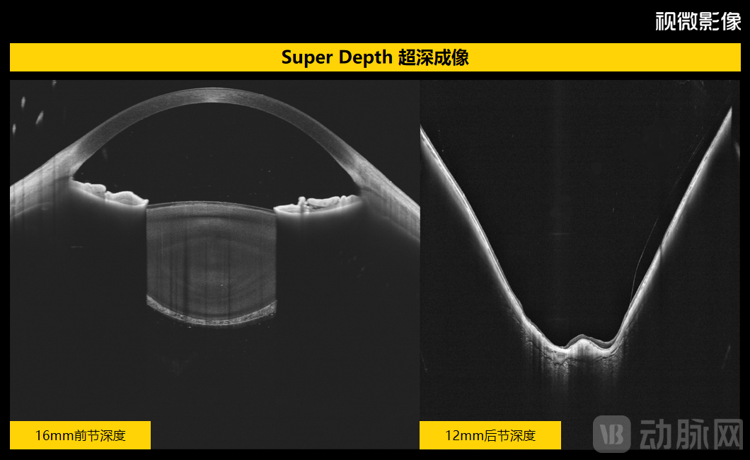 视微影像超深成像.png