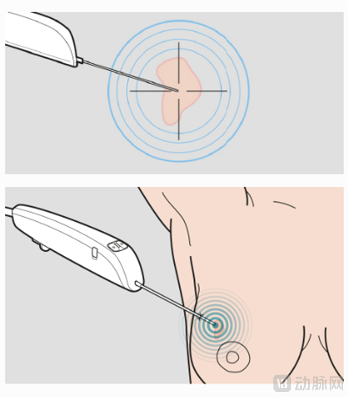 屏幕截图 2023-03-10 160008.png
