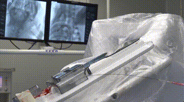 03.手术机器人辅助颈动脉球囊递送.gif