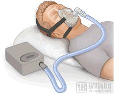在呼吸道施加压力的人工呼吸器.png