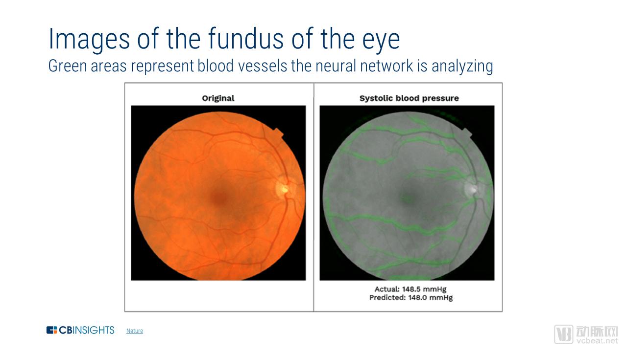 fundus.png