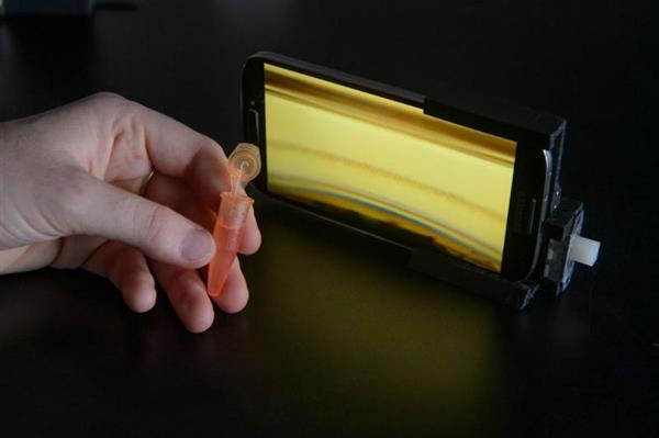 3D打印便携装置+智能手机可检测镰状细胞病