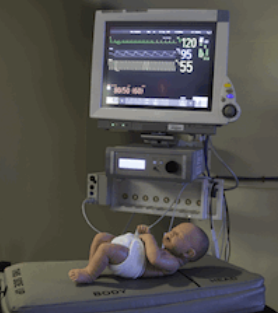 哈佛威斯研究所成功检测了基于振动模式的婴儿呼吸暂停预防设备
