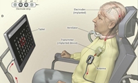 【震惊】世界首例成功的人类脑机接口实验：让全身瘫痪病人可以通过思想进行交流